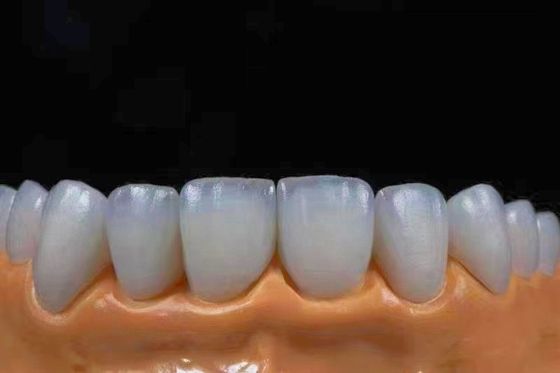 comprar Coroas de zircônia estética altamente translúcidas, perfeitas para a aparência natural Fabricação em linha