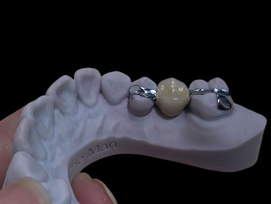 comprar Dentário de ponta de Maryland de longa duração, personalizável para restauração. Fabricação em linha