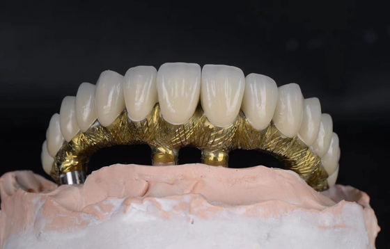 comprar Implantes e coroas dentárias de liga de titânio de aparência natural e resistentes à corrosão Fabricação em linha