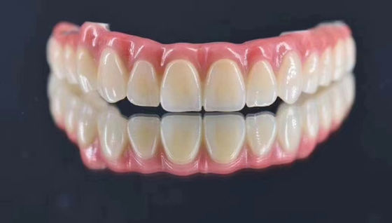 comprar Laboratório Dental Implante personalizado apoiado coroa de metal natural à procura de estabilidade a longo prazo Fabricação em linha