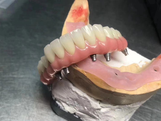 comprar Implante sólido de alta translucidez com coroa de suporte personalizável para restauração dental Fabricação em linha