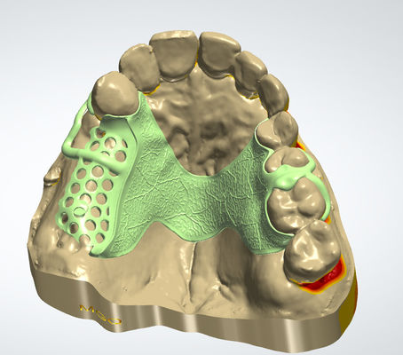comprar Quadro digital de metal CAD CAM Design dental Material de couro com impressão 3D Fabricação em linha