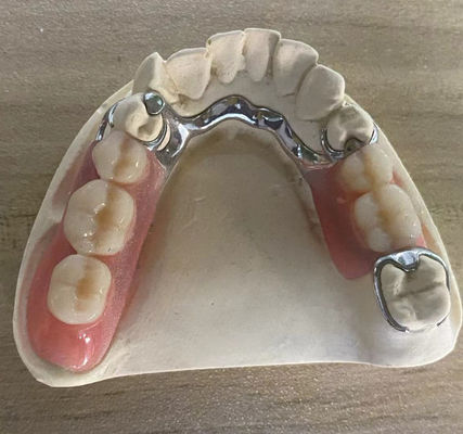 comprar Confiavel Quadro de Prótese de Prata de Metal Resistente à Corrosão Com Design Personalizável Fabricação em linha