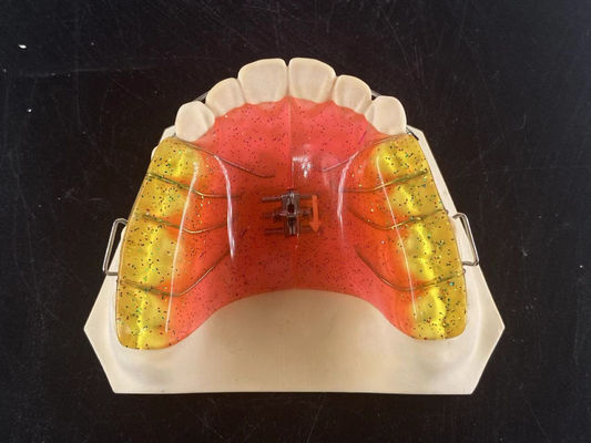 comprar Aplicativo de ortodontia ajustável de expansão de arco dental de 2 vias personalizado Fabricação em linha