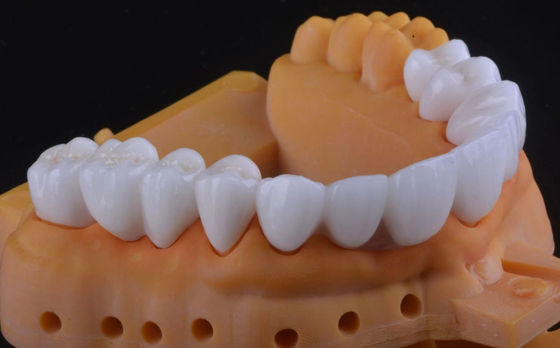 Coroa dentária de zircônio de alta resistência ultratranslúcida com estabilidade a longo prazo