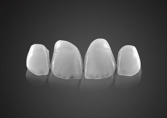 IPS 0.2mm Ultra fina Emax Veneers resistente a manchas com alta resistência