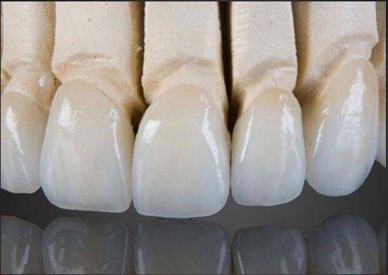 Wieland Zirconia All Ceramic Crown Pintura interna personalizada com design CAD