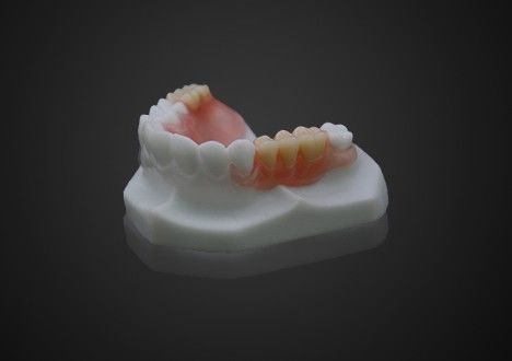 Peso leve Confortável Valplast Dentadura parcial Fácil de limpar Alta transparência