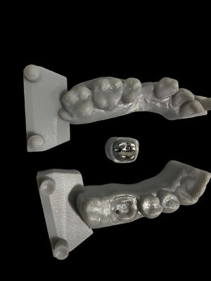 Postes metálicos resistentes à corrosão e núcleo de alta adesão para restauração dentária