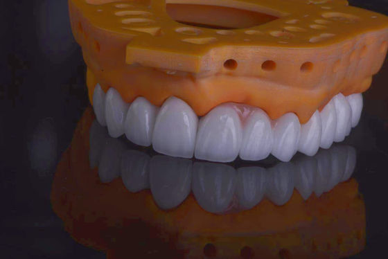 Coroas de laboratório dentário de alta resistência natural em busca de restauração dentária
