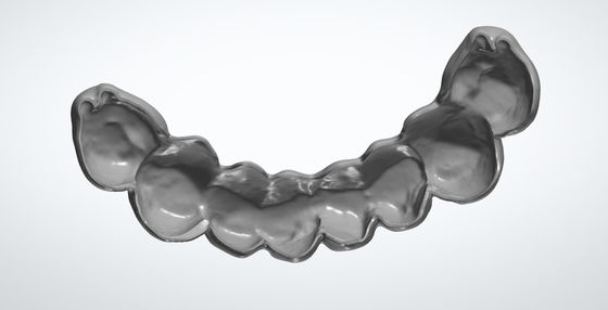 Concha de ovo moído CAD CAM Projeto dentário para implante de ponte temporária PMMA
