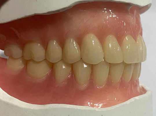Dentes de acrílico personalizados de aparência natural para retenção ideal