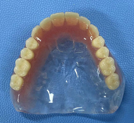 Resistência a manchas Dentadura acrílica completa Alta estabilidade com forma de arco completo