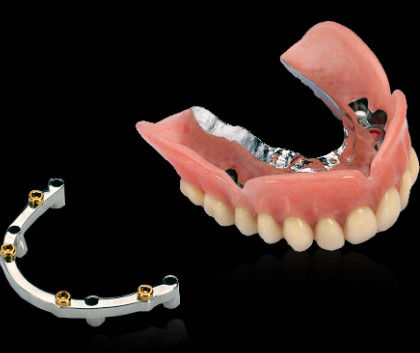 Parafuso de barras de implantes dentários de titânio moído com superfície polida lisa
