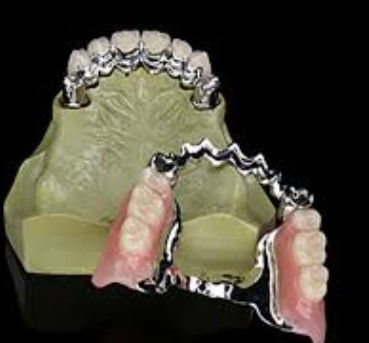 Dentária de chave e porta-chave personalizada de uso a longo prazo com alta resistência